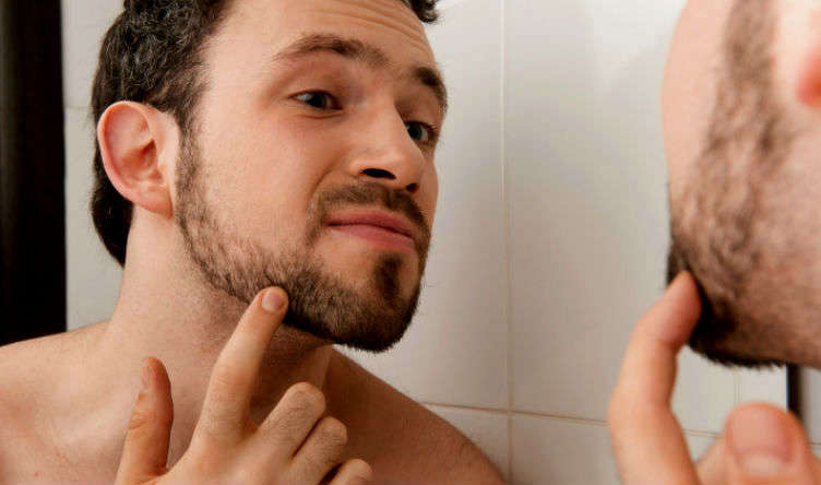 Homem-No-Espelho-Barba-rala-falhada-que demora-para-crescer