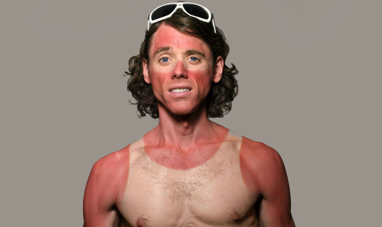 Homem No Espelho - Só um dia sem passar filtro solar pode detonar sua pele para sempre