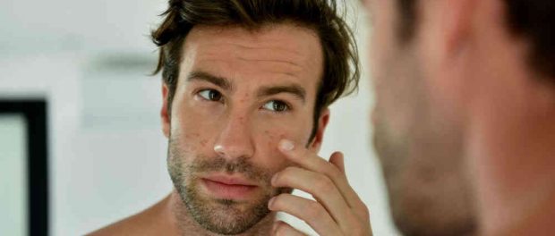 Homem-No-Espelho-Verdades-e-mentiras-sobre-a-acne