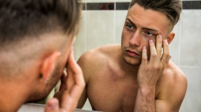 Como prevenir rugas e marcas de idade - Homem No Espelho